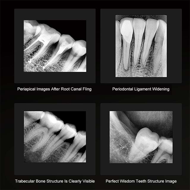 Máquina de rayos X dentales de alto rendimiento para hospitales MY-D042N