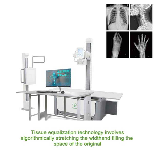 Equipo de rayos X Máquina de rayos X HF de diagnóstico digital médico D023G